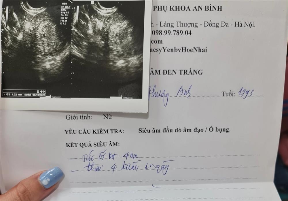 Hà Nội: Công an điều tra vụ người phụ nữ bị đánh sảy thai khi đi ăn tối-2
