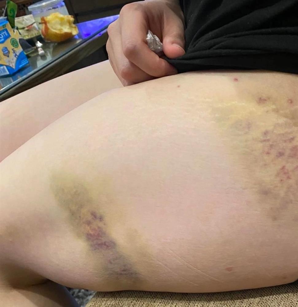 Hà Nội: Công an điều tra vụ người phụ nữ bị đánh sảy thai khi đi ăn tối-3