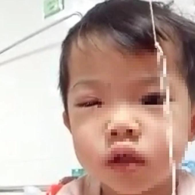 Bé gái 2 tuổi bị xịt hơi cay vào mắt trong vụ xô xát của người lớn-2