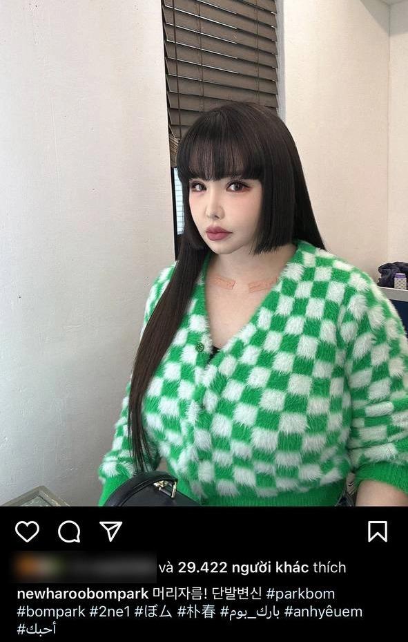 Park Bom khoe ảnh mới nhưng lại khiến fan lo lắng-1