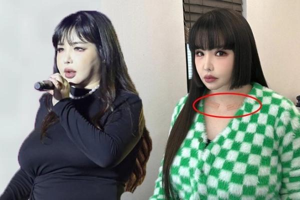 Park Bom 2NE1 gây sốc với ngoại hình lạ sau giảm cân-3