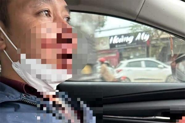 Công an xác minh phụ huynh bị hành hung sau khi làm việc với hiệu trưởng-2