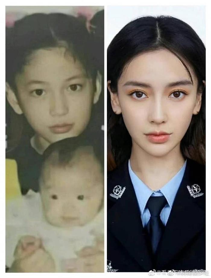 Angelababy sở hữu nhan sắc bao năm không đổi nhờ tip niềng răng đặc biệt-2