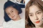 Angelababy sở hữu nhan sắc bao năm không đổi nhờ tip niềng răng đặc biệt