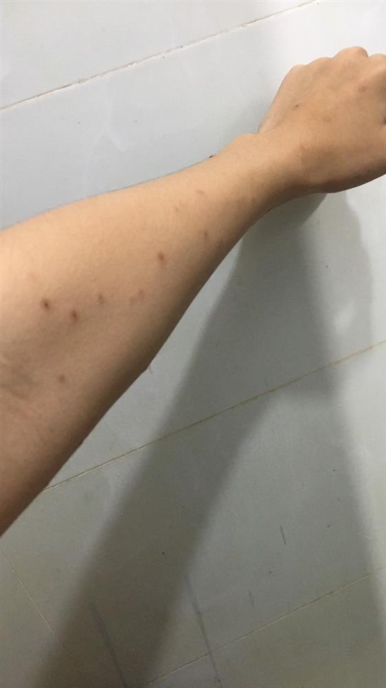 Bé 14 tuổi nhiễm HIV, giang mai, nghi sùi mào gà: Cảnh báo quan hệ tình dục sớm-1