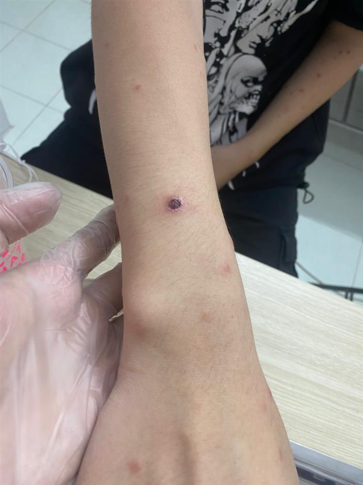 Bé 14 tuổi nhiễm HIV, giang mai, nghi sùi mào gà: Cảnh báo quan hệ tình dục sớm-3