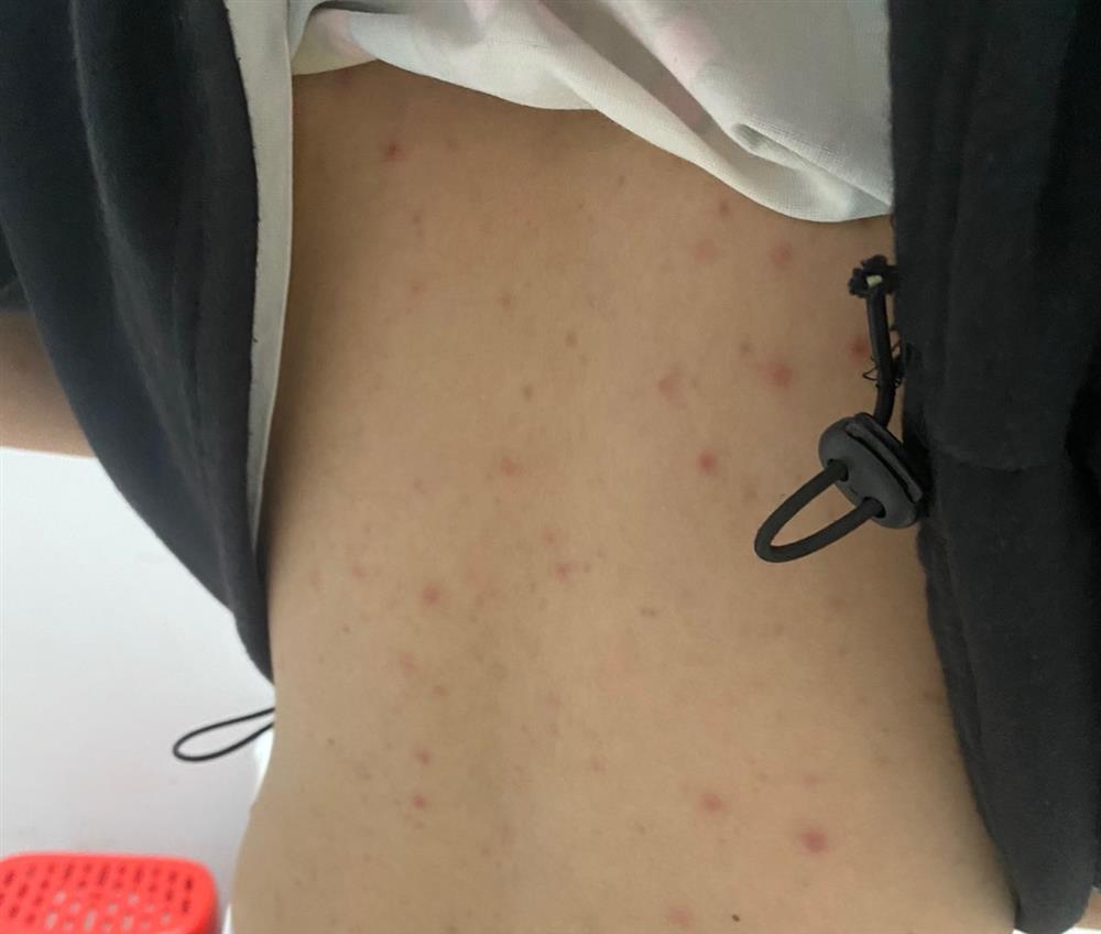 Bé 14 tuổi nhiễm HIV, giang mai, nghi sùi mào gà: Cảnh báo quan hệ tình dục sớm-4