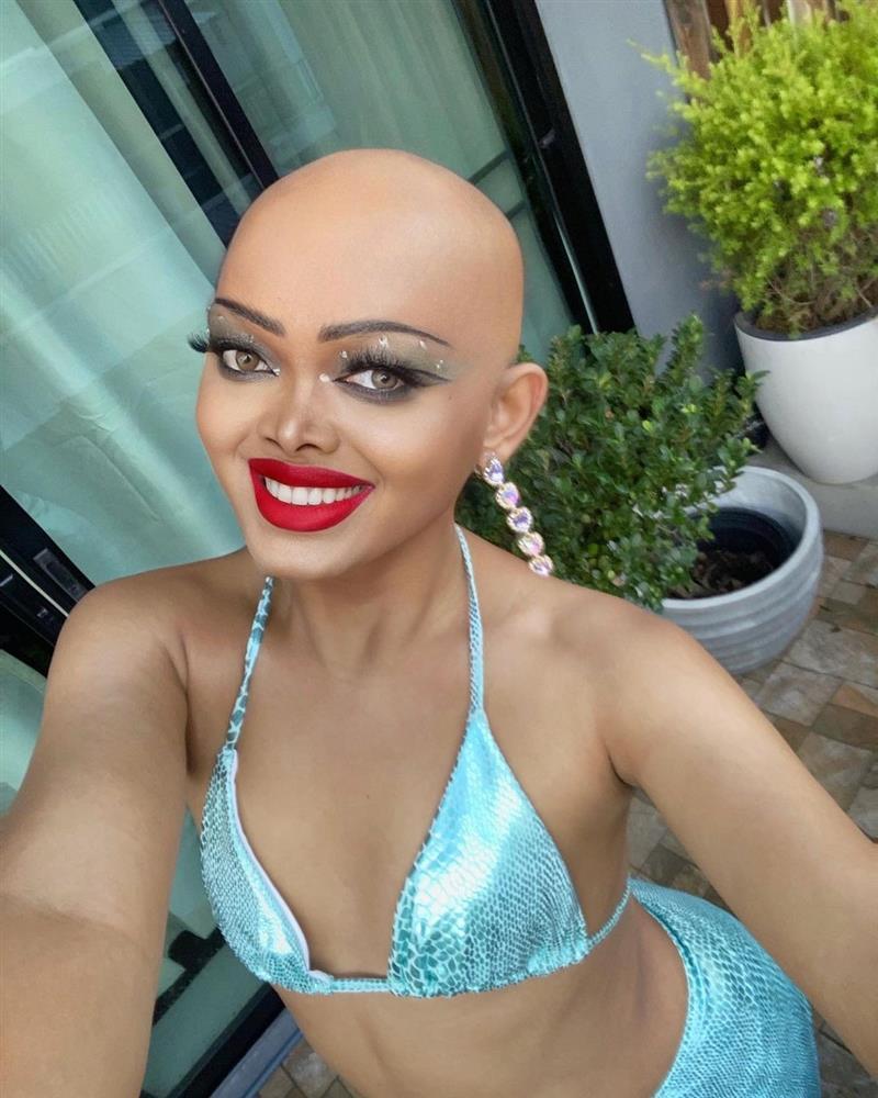 Người đẹp đầu trọc gây tranh cãi khi đăng quang hoa hậu-2