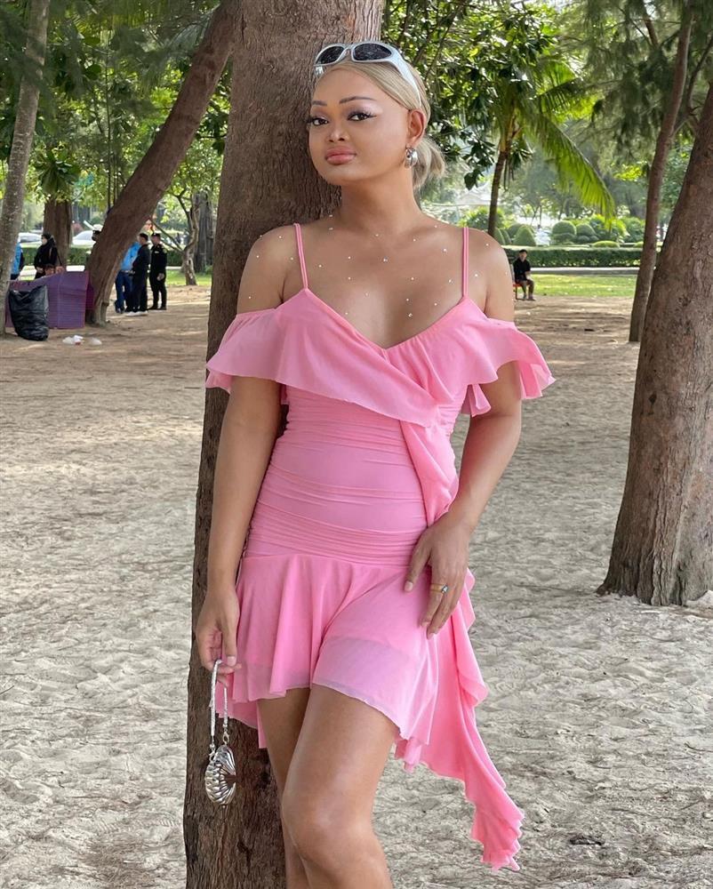 Người đẹp đầu trọc gây tranh cãi khi đăng quang hoa hậu-4