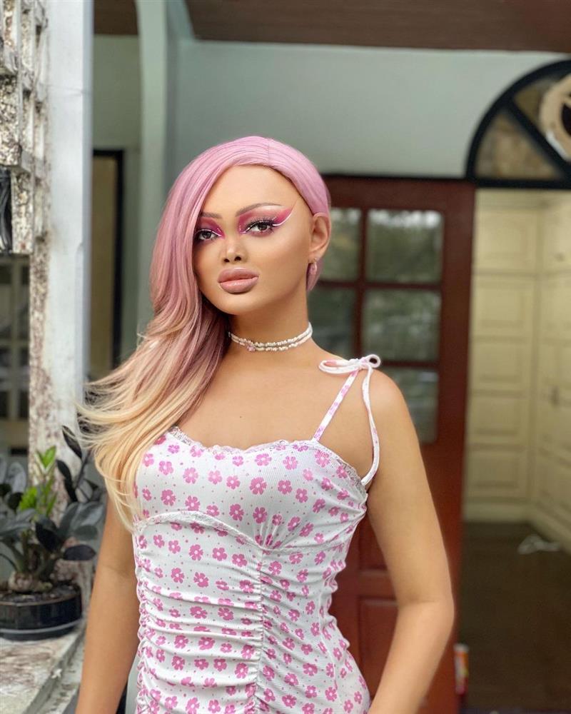 Người đẹp đầu trọc gây tranh cãi khi đăng quang hoa hậu-9