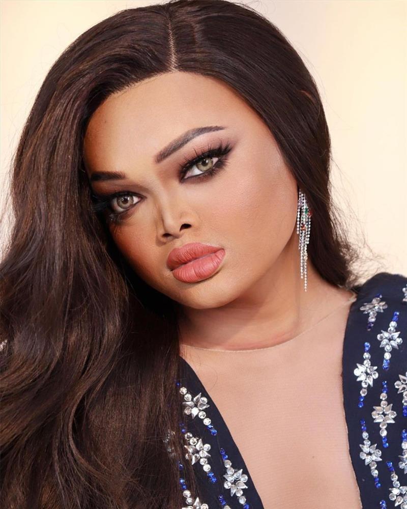 Người đẹp đầu trọc gây tranh cãi khi đăng quang hoa hậu-10