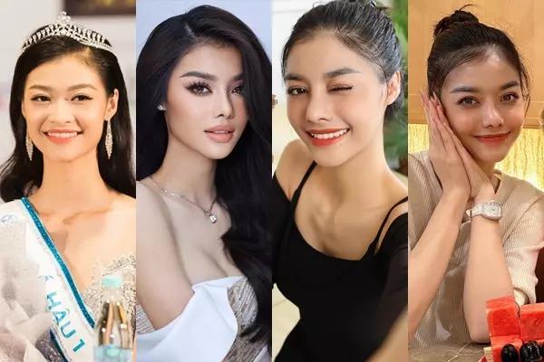 Á hậu Kiều Loan xinh đẹp sau hình ảnh băng mũi ngày sinh nhật-13