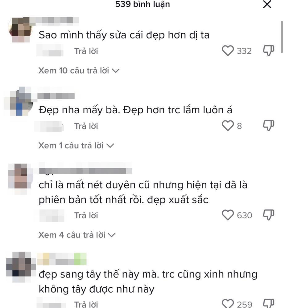 Á hậu Kiều Loan xinh đẹp sau hình ảnh băng mũi ngày sinh nhật-6