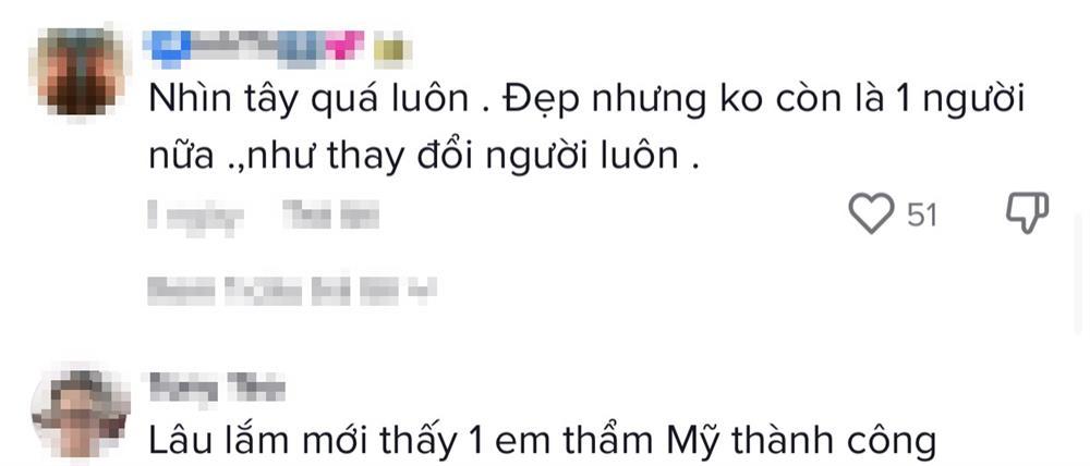 Á hậu Kiều Loan xinh đẹp sau hình ảnh băng mũi ngày sinh nhật-7