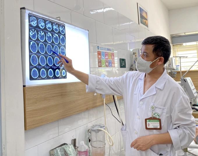 37 công nhân nhiễm độc methanol: Người tử vong, người hỏng mắt-2