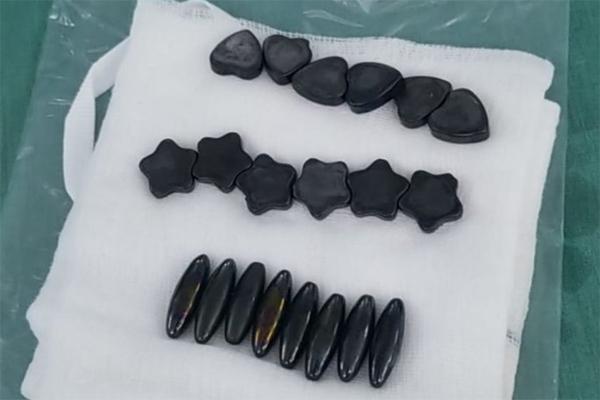 Nhiều nơi từ chối mổ, bé trai đau đơn vì khối u khổng lồ ở mắt-2