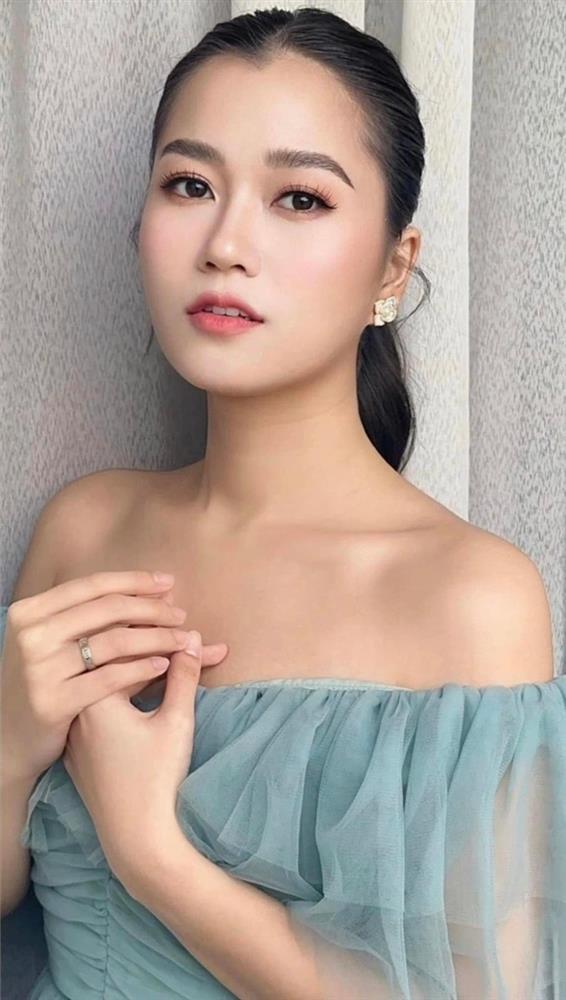 Vướng nghi án dao kéo vì nhan sắc thăng hạng, Lâm Vỹ Dạ nói gì?-4