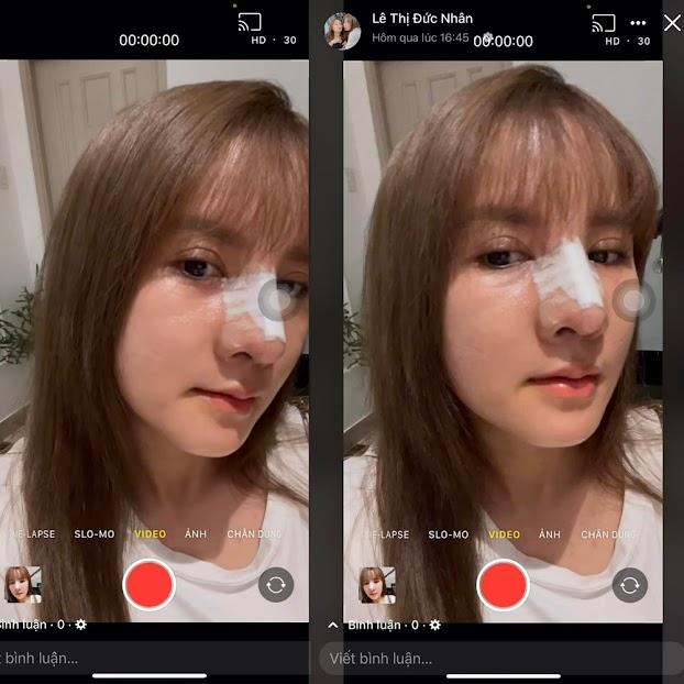 Bà Nhân Vlog bị đào loạt ảnh thời chưa phẫu thuật thẩm mỹ-3