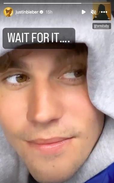 Tình trạng liệt nửa mặt của Justin Bieber hiện ra sao?-2