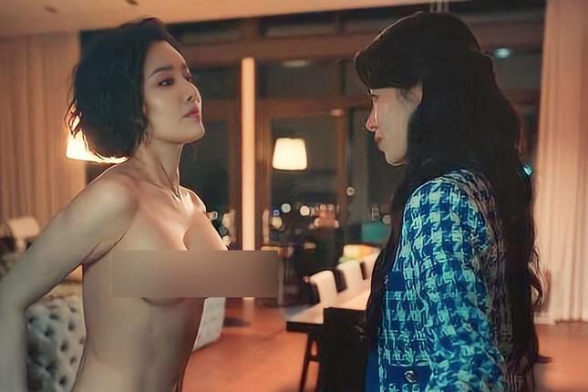 Ác nữ đóng cảnh nóng The Glory 2 hé lộ bí quyết tăng size vòng 1 rẻ bèo-1