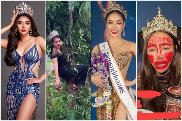 Hoa hậu Thái Lan công khai ảnh chụp vết sẹo lớn sau thẩm mỹ-5