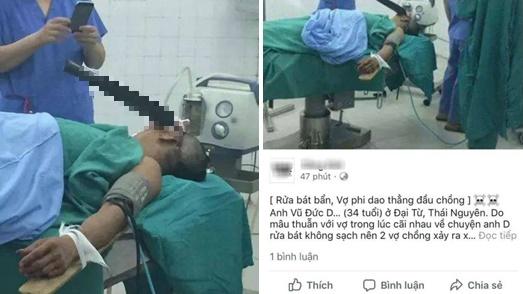 Xôn xao thông tin chồng rửa bát bẩn, bị vợ phi dao thẳng đầu-2