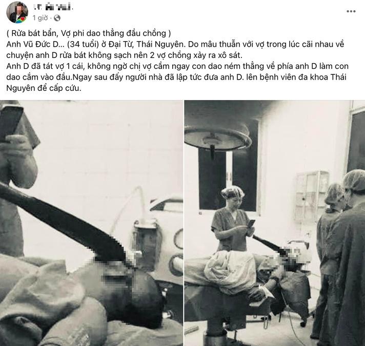 Xôn xao thông tin chồng rửa bát bẩn, bị vợ phi dao thẳng đầu-1