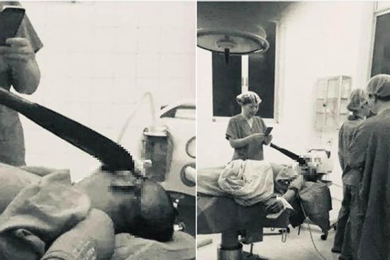 Xôn xao thông tin 'chồng rửa bát bẩn, bị vợ phi dao thẳng đầu'