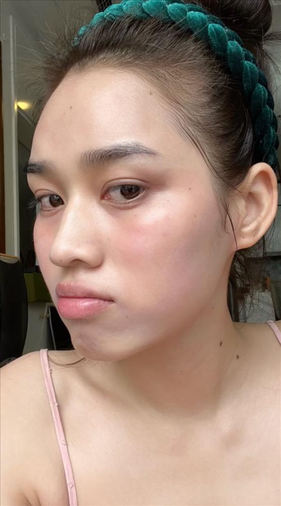 Sai lầm của Đỗ Thị Hà khi dùng Retinol khiến da kích ứng, bỏng rát-1