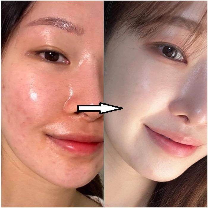 Bỏ túi những cách chăm sóc da giúp nhìn trẻ hơn tuổi-7