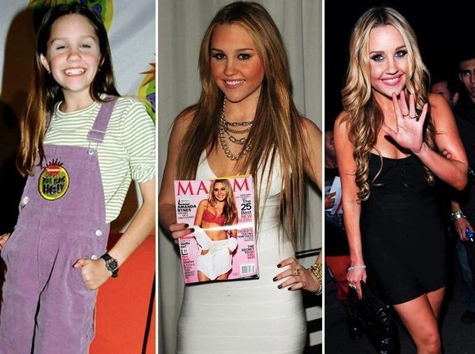 Vết trượt đáng tiếc của ngôi sao khỏa thân lang thang trên phố Amanda Bynes-3