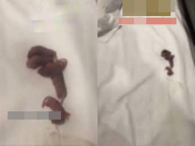 Nằm giường khách sạn thấy âm thanh lạ, choáng nặng khi lật gối lên-2