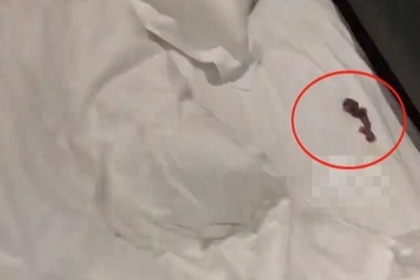 Sốc khi bị kẻ lạ mặt sờ soạng lúc đang ngủ với bạn gái ở khách sạn-3