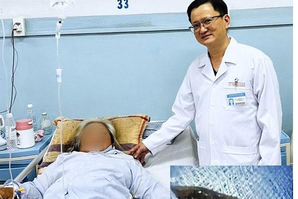 Nhập viện sau 3 ngày ăn thịt vịt-1