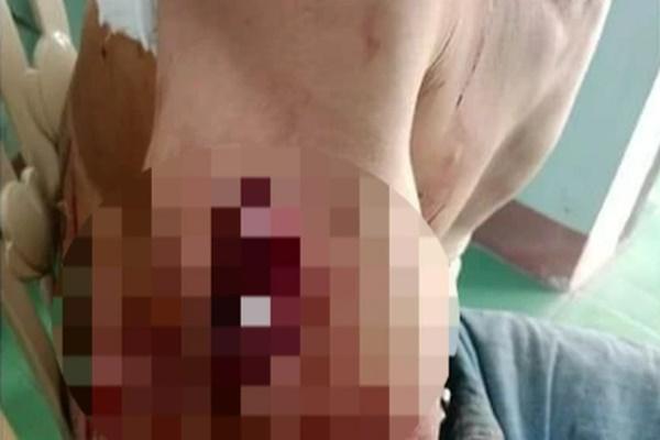 Đập vỡ bát tô lấy mảnh sành đâm hàng xóm nhiều nhát-1