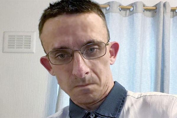 Người đàn ông cao thêm 45cm sau khi cắt bỏ u não-1