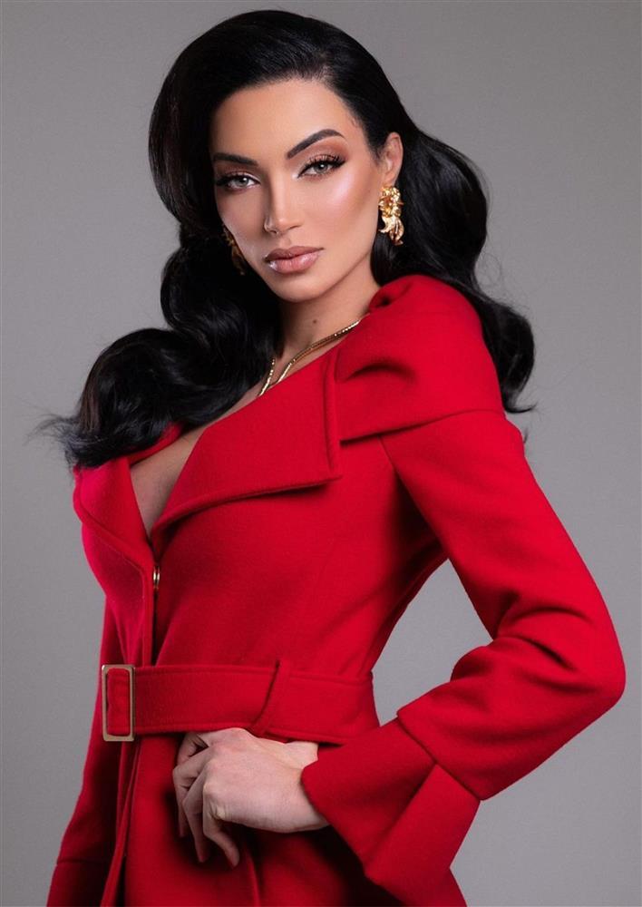 Tuổi thơ bất hạnh, bị kỳ thị của tân Hoa hậu Chuyển giới Brazil-2