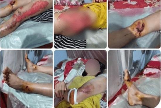 Thực hư tin 'con dùng xe máy kéo lê mẹ đẻ trên đường' ở Yên Bái