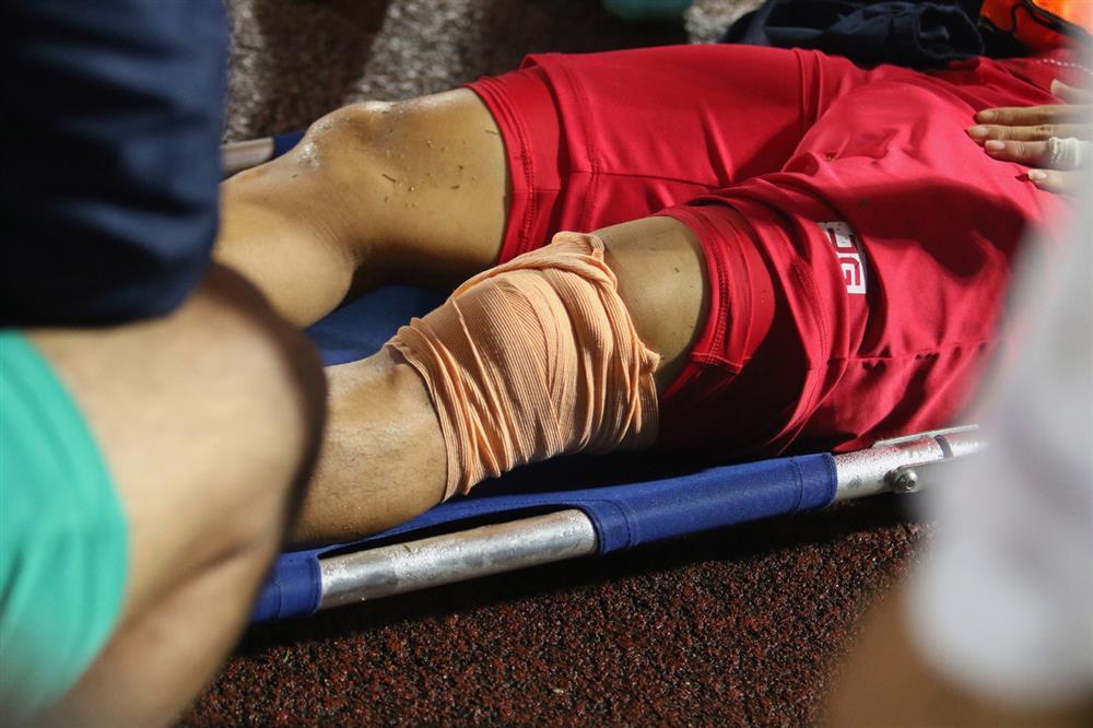 Cầu thủ Hải Phòng chấn thương kinh hoàng, nhập viện cấp cứu-1