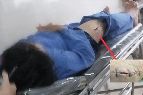 Vì sao cán bộ Cục thuế Ninh Bình bị đâm trọng thương?-1