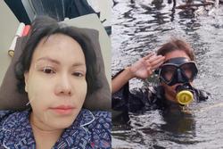 Việt Hương bị lệch mặt do ngâm nước liên tục 35 ngày