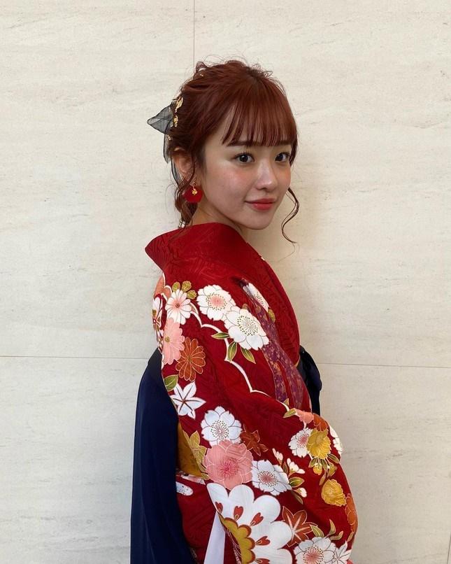 Màn dậy thì thành công của ‘nhóc Maruko’ phiên bản người thật-3