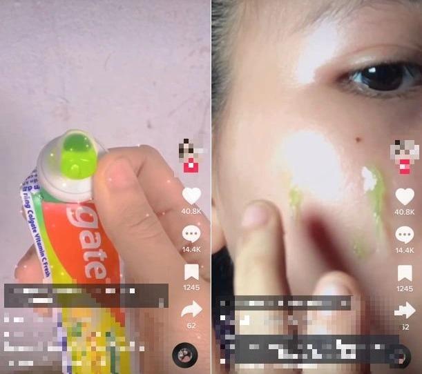 Nát mũi, hỏng mặt, biến chứng thai kì vì bác sĩ TikTok-4