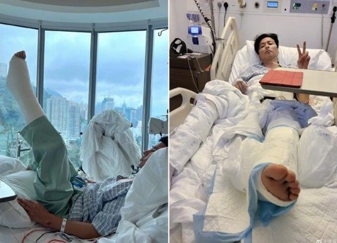 Sao Diệp Vấn gặp tai nạn nghiêm trọng ở phim trường, phải phẫu thuật-1