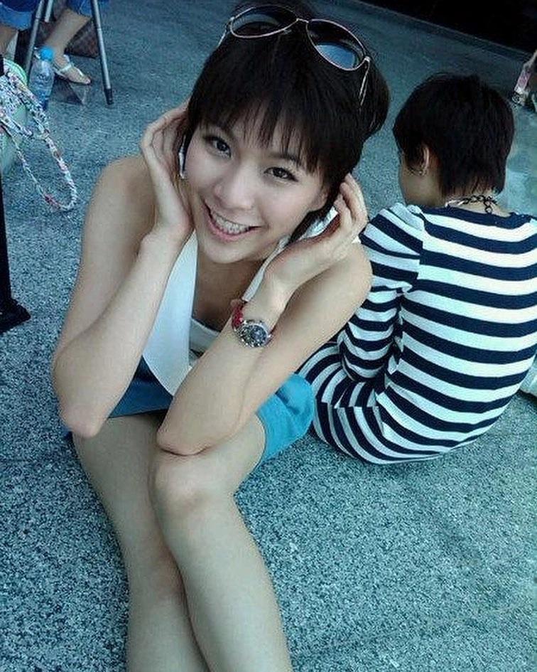 Bạn gái Mario Maurer công khai loạt ảnh trước phẫu thuật thẩm mỹ-1