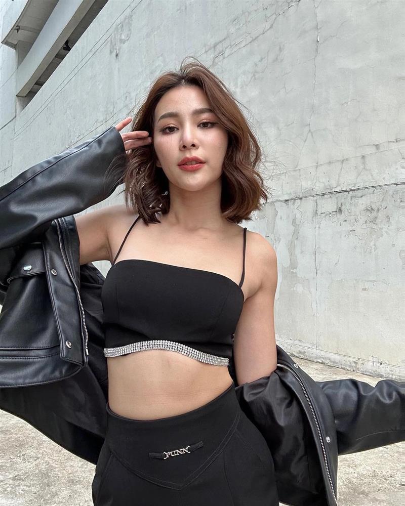 Bạn gái Mario Maurer công khai loạt ảnh trước phẫu thuật thẩm mỹ-5