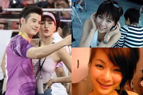 Bạn gái Mario Maurer công khai loạt ảnh trước phẫu thuật thẩm mỹ