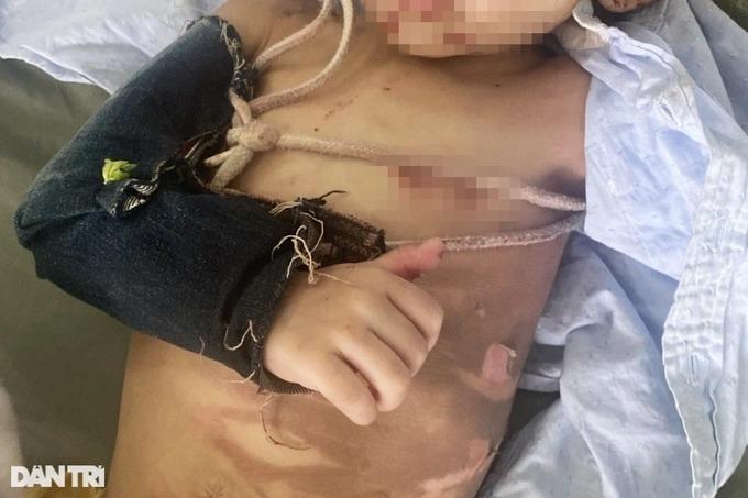 Cấp cứu bé 2 tuổi ở TPHCM người đầy vết thương, nghi bị cha bạo hành 3 ngày-1