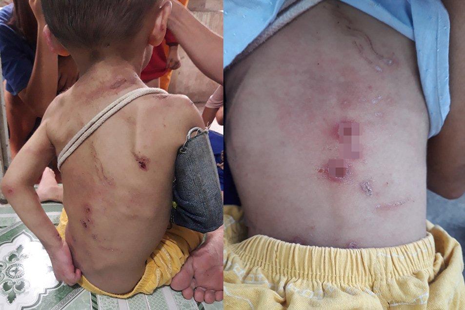 Chồng túm tóc, đấm, đá vào mặt vợ ở Đà Nẵng-4