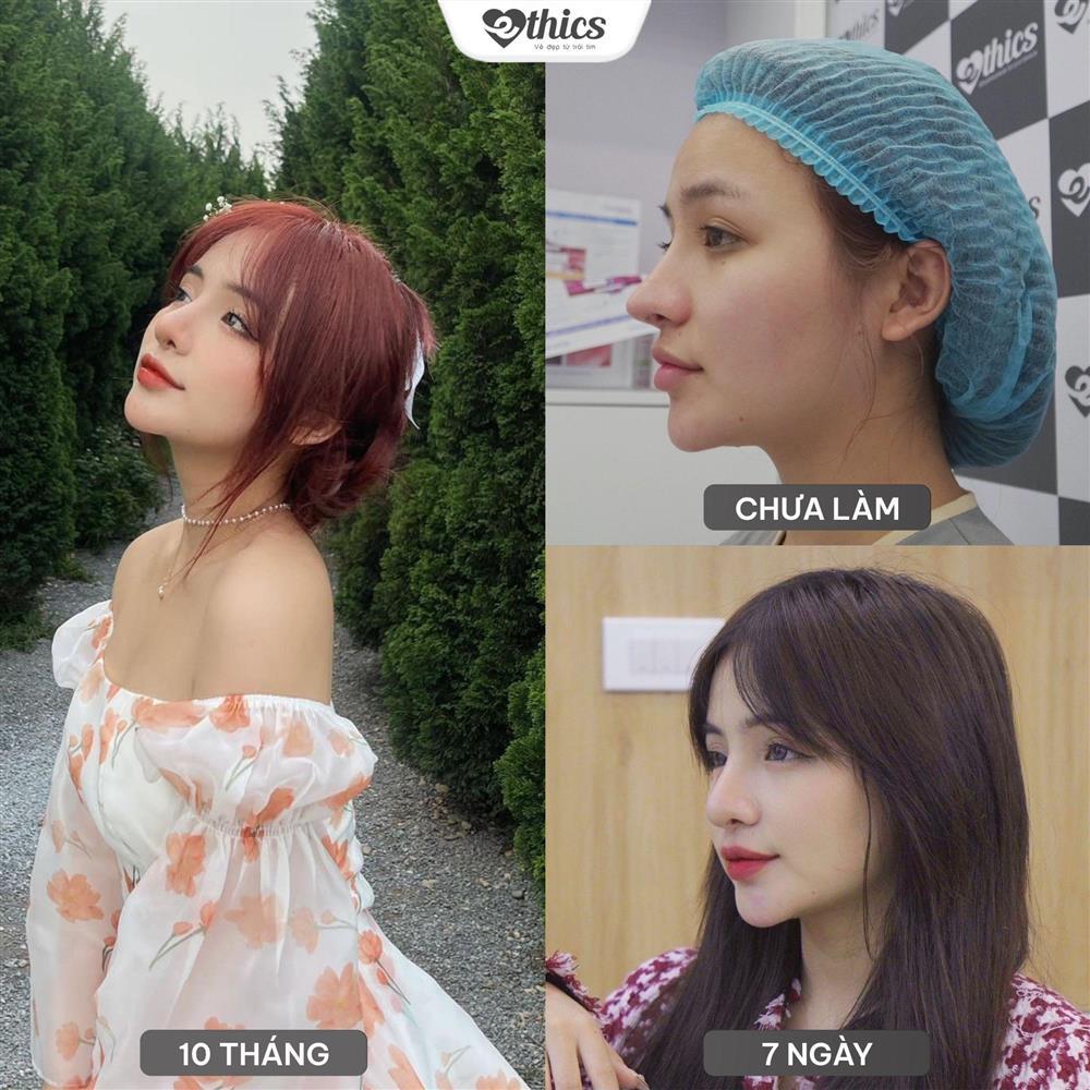 Thẩm mỹ Ethics - địa chỉ ‘tân trang’ nhan sắc của hot face-4